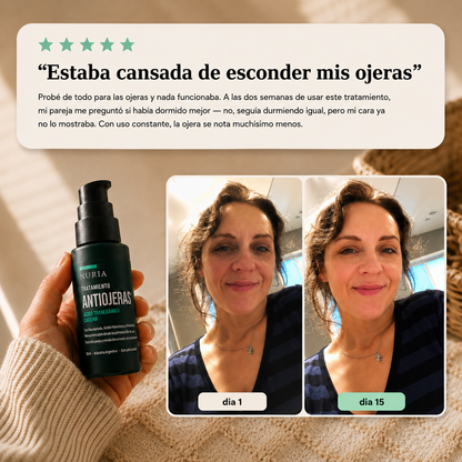 TRATAMIENTO ANTI-OJERAS